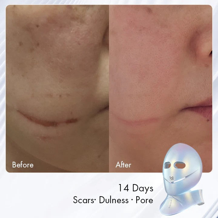 The Radiance Kit (Mask&Neck)