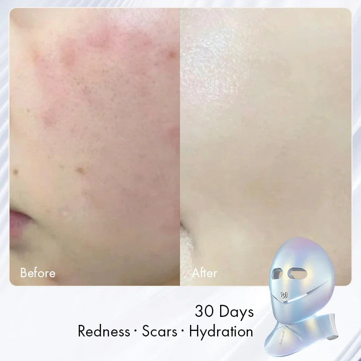 The Radiance Kit (Mask&Neck)